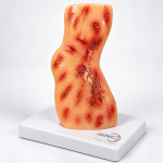 Abrasion of Forearm Concrete Road Accident Model